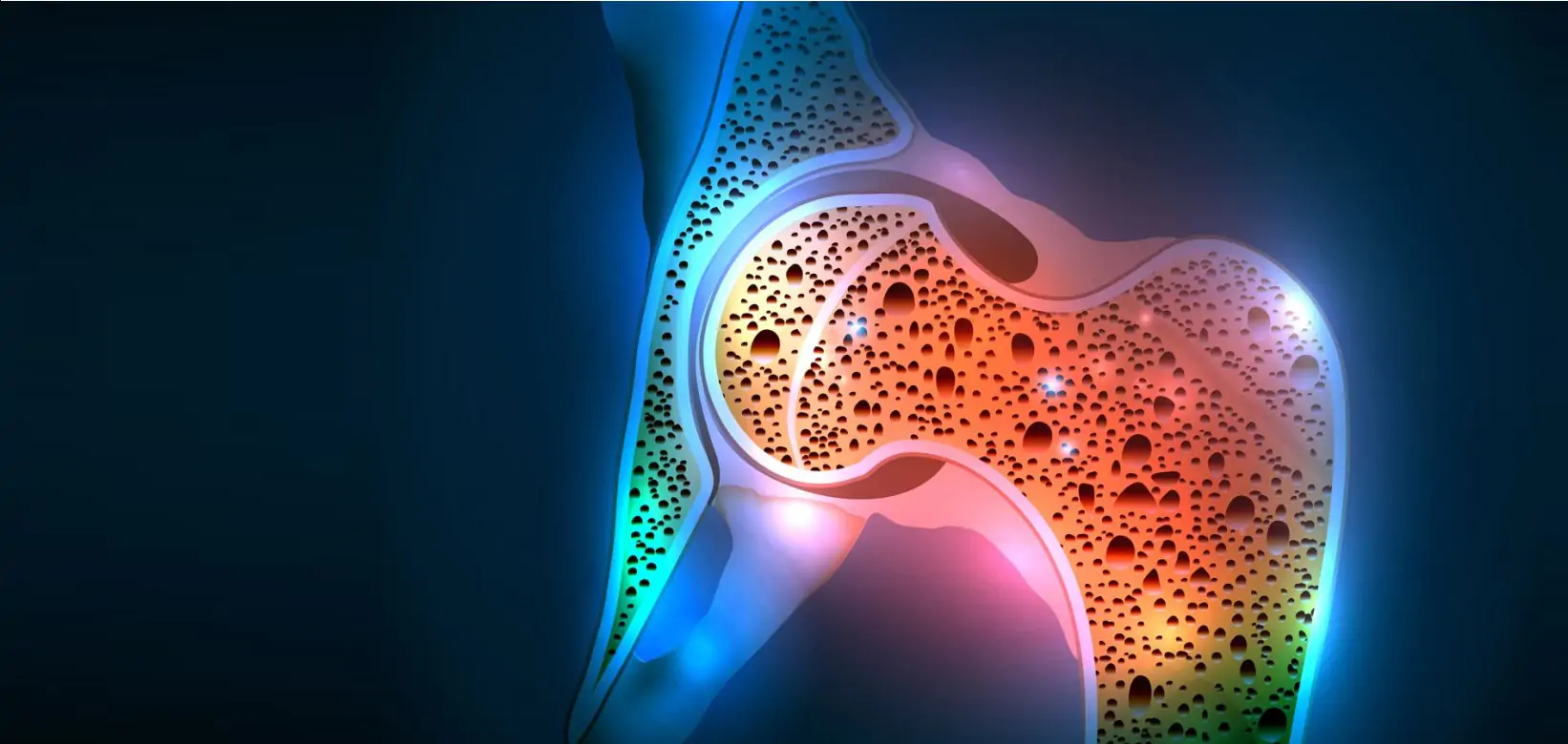 ЧЕК-АП «Скрининг остеопороза»